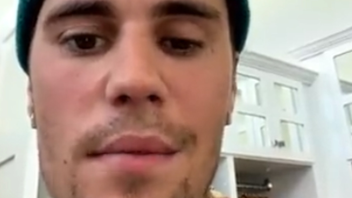 Justin Bieber: il morbo di Lyme e la paralisi al volto